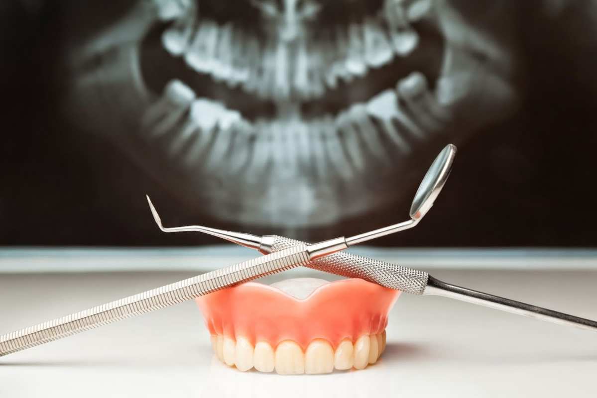 Открытка рентген челюсти  с днем стоматолога   Happy dentist day 