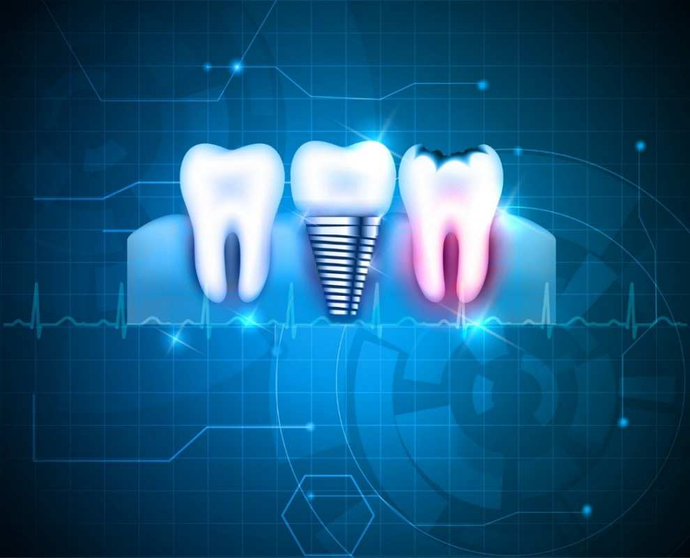 Открытка арт с зубами  с днем стоматолога   Happy dentist day 